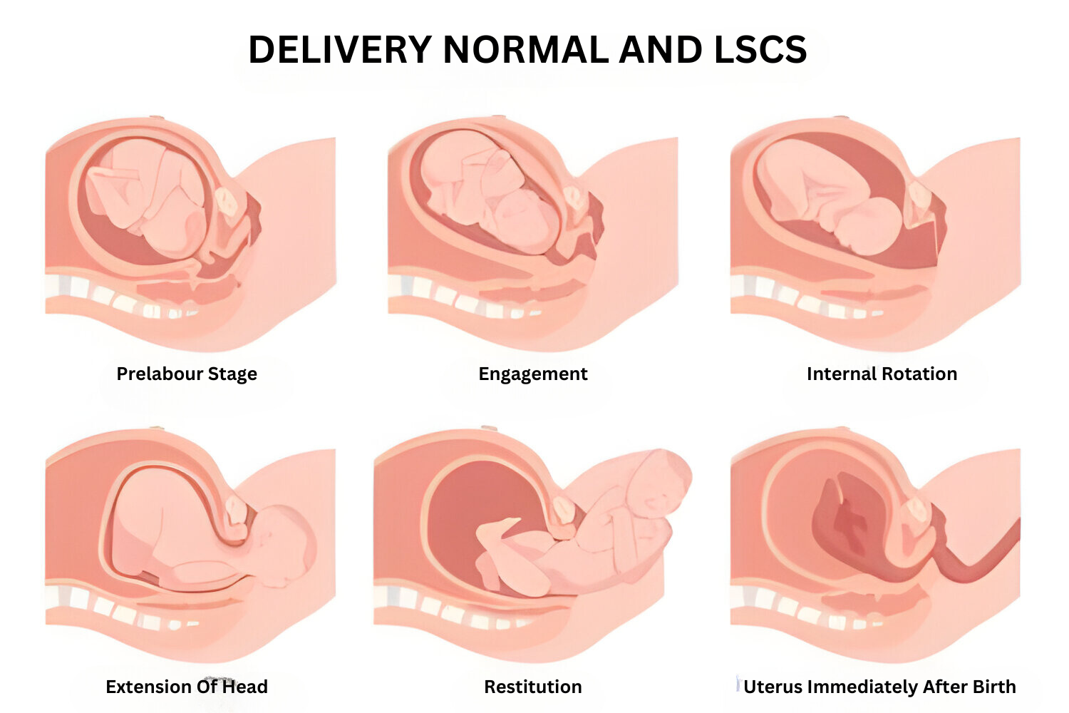 Maternity Hospital in Kalyani Nagar | Normal Delivery in Kalyani Nagar | Dr. Pushpa Soni