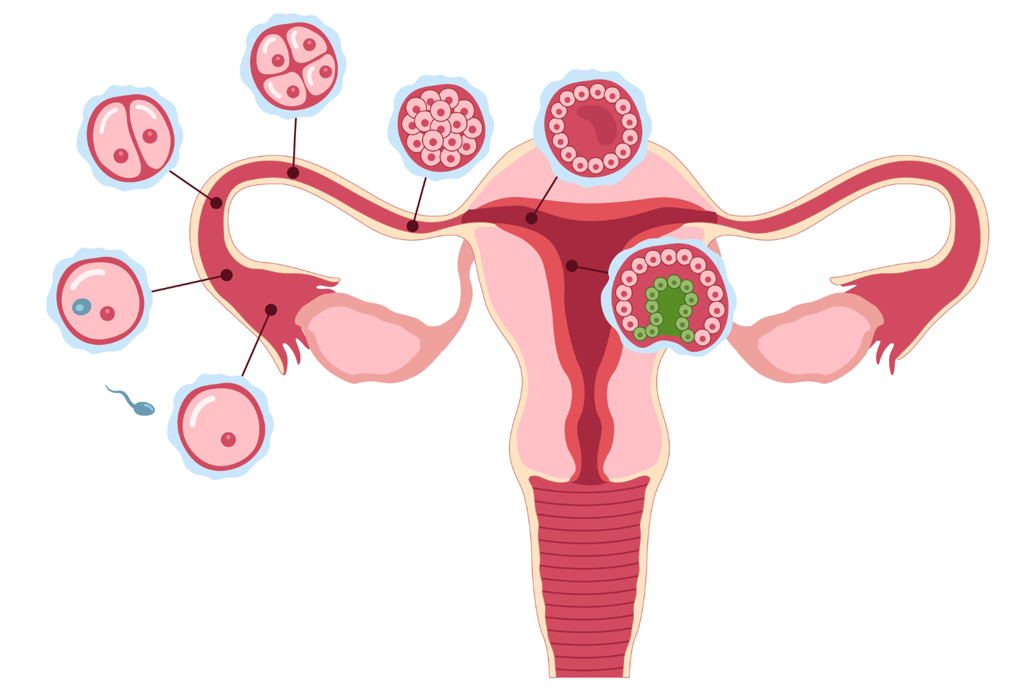 Tubectomy | Tubal Ligation Treatment in Kalyani Nagar, Pune | Dr. Pushpa Soni