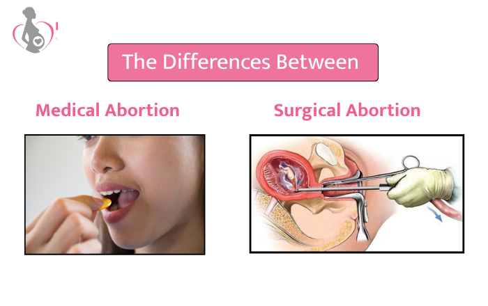 Differences Between Medical Abortion And Surgical Abortion
